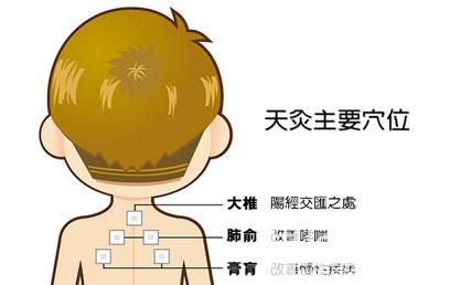 什么是三伏天灸？
