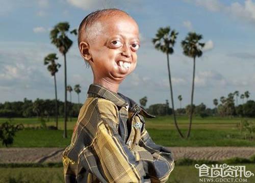 印度早衰少年似僵尸吓人 吃什么食物抗衰老？